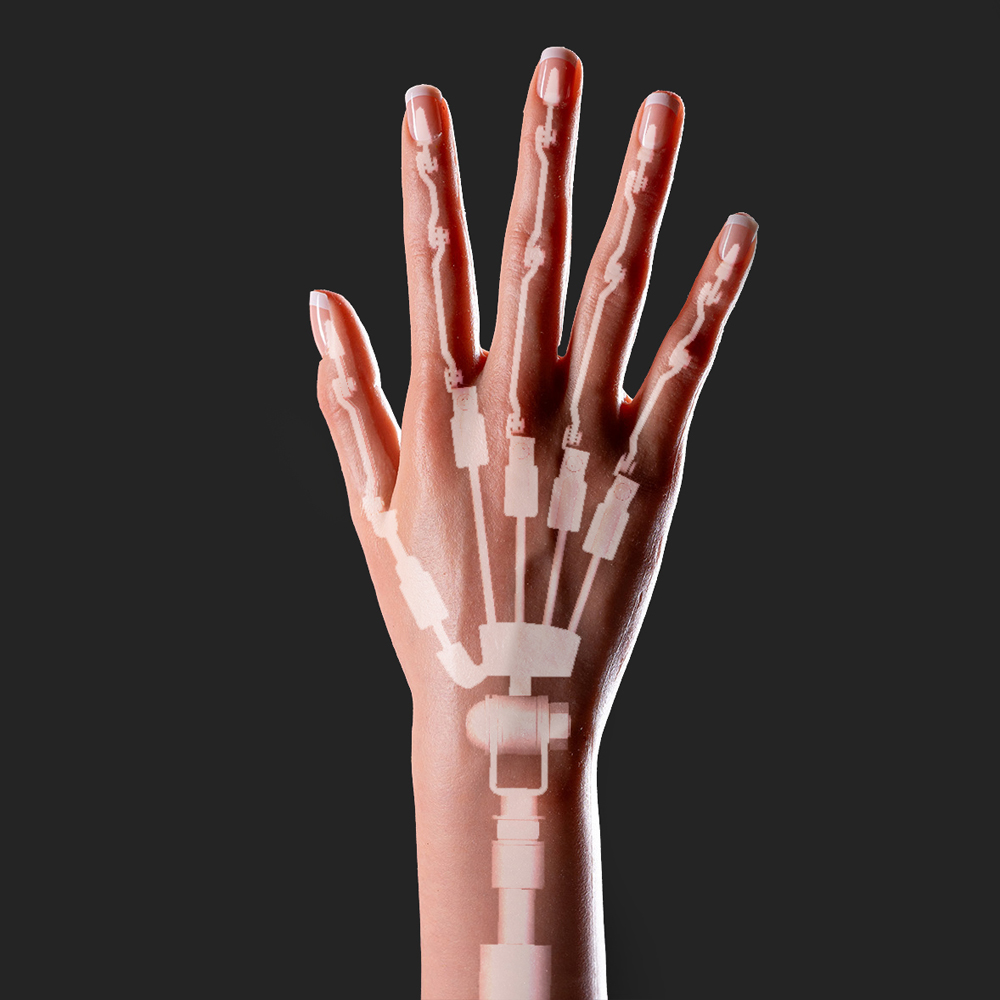 Verstellbare Finger