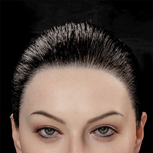 Implantierte [+€245]