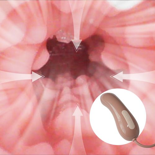 Oralabsaugung [+€75]