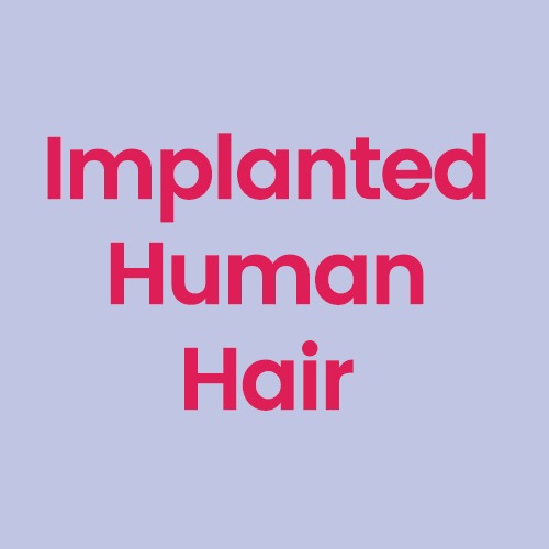 Implanted Hair / Real human hair [+€349]