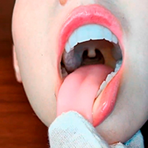 Silikonová hlava s pohyblivou čelistí a ROS