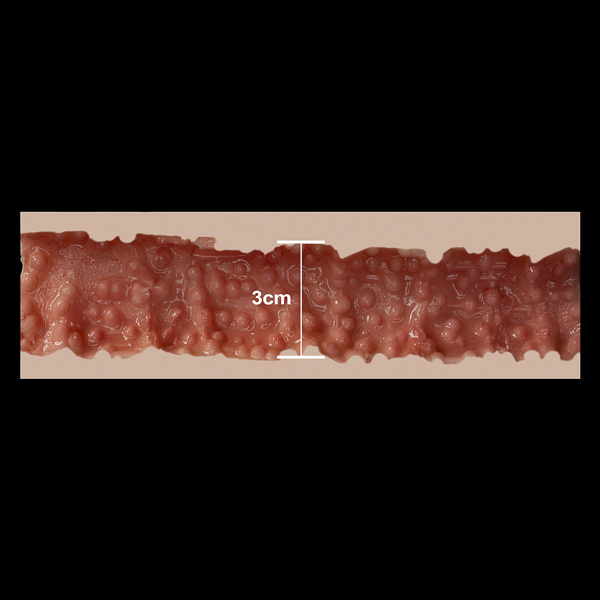 3,0 cm