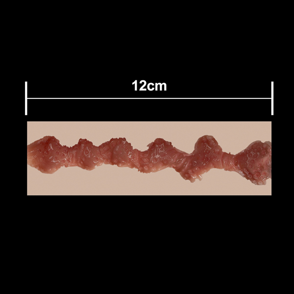 12 cm