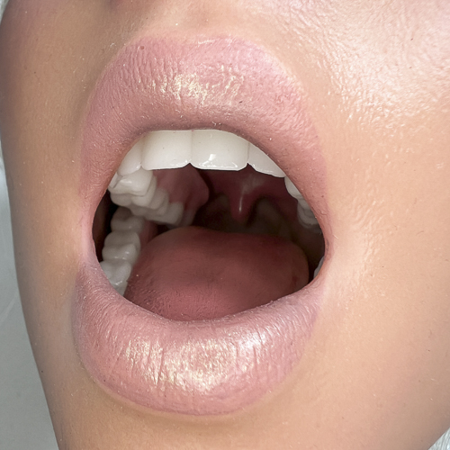 Movable jaw+ROS