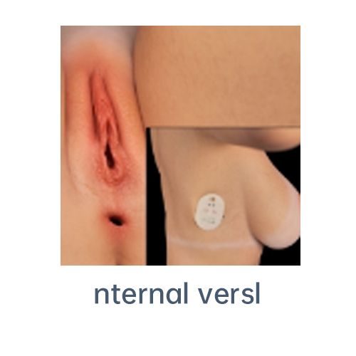 Vaginal suction (built-in device) [+€89]